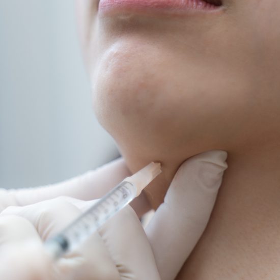 Rejuvenation procedure in beauty clinic injection. Women Injection in her chin.